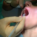 anestesia senza dolore Wand studio Checchi Bologna