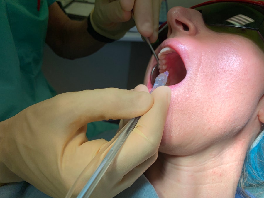 anestesia senza dolore Wand studio Checchi Bologna