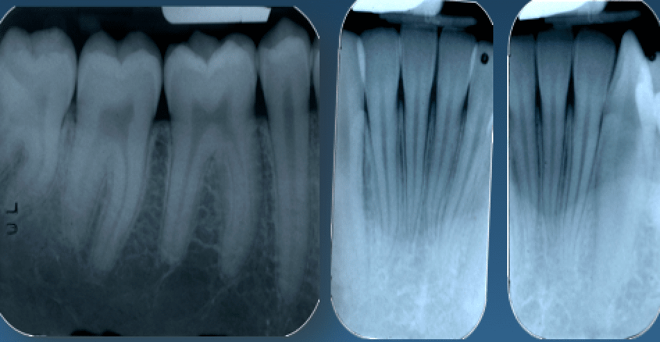 Ho mal di denti cosa fare Prof. Checchi Bologna