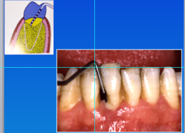Mal di denti cosa fare Prof. Checchi Bologna