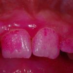 tecnica colorimetrica