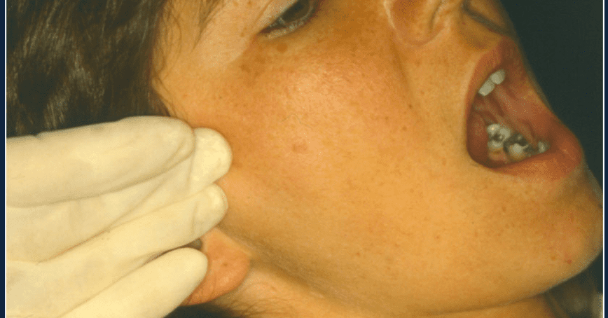 visita di controllo dentista esame atm