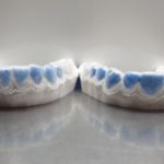 Modelli-in-gesso-sui-quali-vengono-prodotte-le-mascherine-personalizzate-2