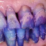 Tecnica Colorimetrica