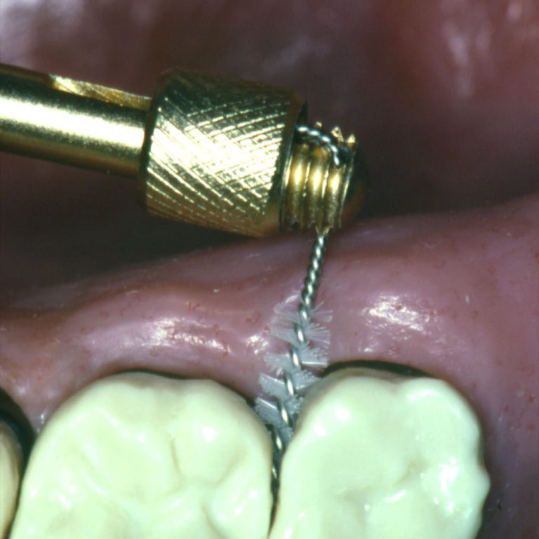 Massaggio gengivale studio odontoiatrico checchi Dentista a Bologna