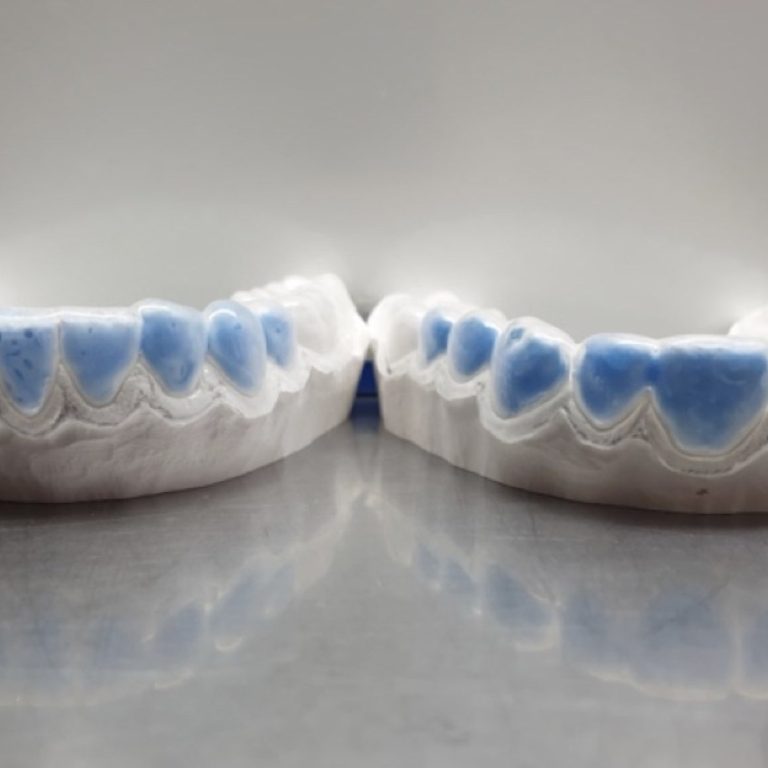 Modelli-in-gesso-sui-quali-vengono-prodotte-le-mascherine-personalizzate-2