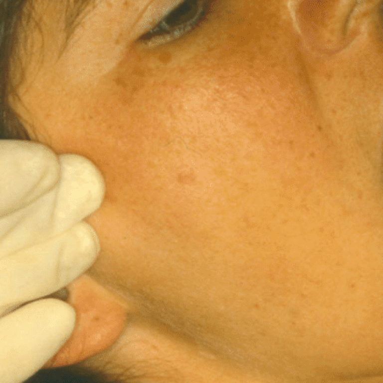 visita di controllo dentista esame atm